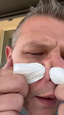 A post by @lvprvention on TikTok caption: 🚨 STOP ! Ne retirez JAMAIS vos points noirs comme ça ! 😱 Vous risquez d’en avoir encore plus et de laisser des cicatrices. 😖 Découvrez ma solution 100% naturelle, super efficace et douce pour une peau nette sans marques ! ✨ #SoinPeau #PointsNoirs #AstuceNaturelle #Beauté 