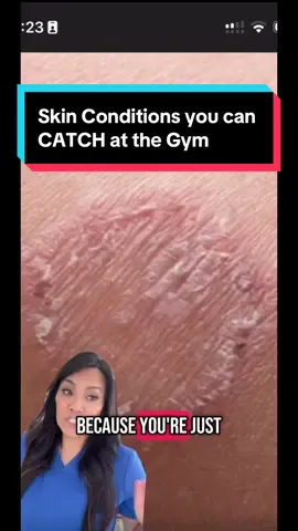 A post by @drpimplepopper on TikTok caption: Muscles grow in the gym but so do fungi and bacteria! How to avoid catching skin infections when you’re tryin to grow those muscles 💪🏼 #drpimplepopper #breakinout Featuring treatments with SLMD BP Wash & SLMD Sal Acid Spray @SLMD, by Dr Pimple Popper 