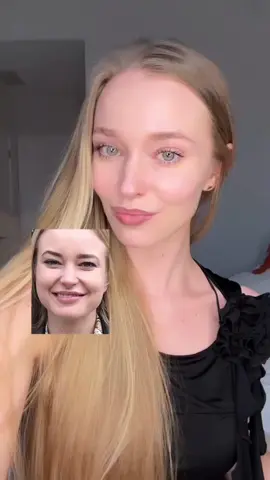 A post by @anastasiabeautyfascia on TikTok caption: What's the TRUTH about Botox? Let’s talk honestly about Botox, and why I believe women should try natural techniques before turning to neurotoxins. 1️⃣ Botox is botulinum toxin - a neurotoxin that paralyzes muscle activity.  And yes, studies show that even localized injections can result in toxin spread, potentially affecting nearby or even distant tissues.  It works by disrupting your neuromuscular connection - meaning the signal from your brain to your muscle is temporarily blocked. 2️⃣ The muscles of the face are interconnected.  They don’t work in isolation - they move as a group.  When one area is paralyzed (like the glabella), others will compensate, working harder to create expression.  That’s why many women who use Botox for frown lines later develop bunny lines, or new tension elsewhere.  It’s not correcting function - it’s redistributing it. 3️⃣ Botox has been linked to bone resorption.  According to Wolff’s Law, bone density is maintained through mechanical stress.  If muscles stop contracting around a bone - because they’ve been paralyzed - the bone gradually weakens.  Less muscle tone also means less circulation.  Your skin may stop receiving the nutrients and lymphatic flow it needs, because facial muscles act as pumps for blood and lymph.  No movement = less flow = stagnation. 4️⃣ Botox doesn’t just affect your appearance - it can alter your emotional experience.  Studies show that facial mimicry is tied to empathy and mood. When we stop expressing emotion through the face, our brain receives less feedback - breaking the loop between emotion, expression and recognition.  We are the only species with this level of facial expressivity.  Numbing it has consequences far deeper than skin.  Hello Mental Health! 5️⃣ And at the end of the day - Botox will never fix your posture, your double chin, or the deep structural tension patterns in your fascia.  It only treats dynamic wrinkles temporarily, and for many, becomes a $50,000 lifetime chase for frozen youth. Instead, I recommend: ✨ Work on your skin quality ✨ Support circulation through the major vessels of the neck and face ✨ Release tension through muscle and fascia work ✨ Restore the tone and balance that lifts naturally Your face is capable of change - through intelligent, intentional care. Learn how to work with your structure, not against it. Follow my page for natural tools that transform the way you age - from the inside out. Where to start? Try the 10-Min Full Face Massage Routine that's pinned on my Page (Posts, not Reels). Share your own Botox experiences in the comments 👇