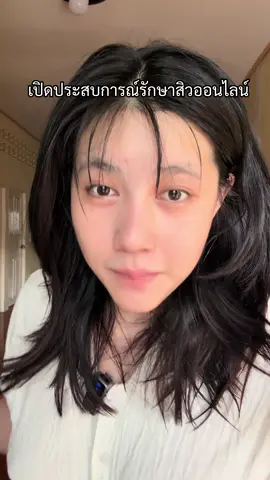 A post by @nan_warisara__ on TikTok caption: เปิดประสบการณ์คนเป็นสิว #แนนวริศรา 