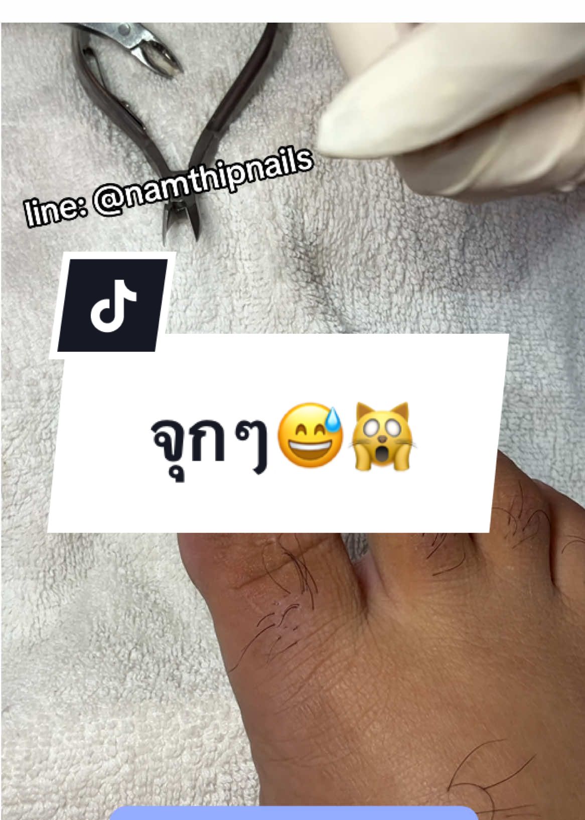 A post by @namthipnails5 on TikTok caption: 💓 #namthipnails #ตัดเล็บขบ #ตัดหนัง #ทำเล็บ #ร้านตัดเล็บขบ #ร้านตัดเล็บขบราม2 #ตัดเล็บ #เล็บขบ  #เล็บเชื้อรา Fb : namthipnails  Line : @namthipnails  นัมเบอร์วัน8 ตลาดม.ราม2  กทม  Map: namthipnails  https://goo.gl/maps/JmwpCKLfKwmhKGK96  ร้านเปิดทุกวัน เวลา12.00น-22.00น.