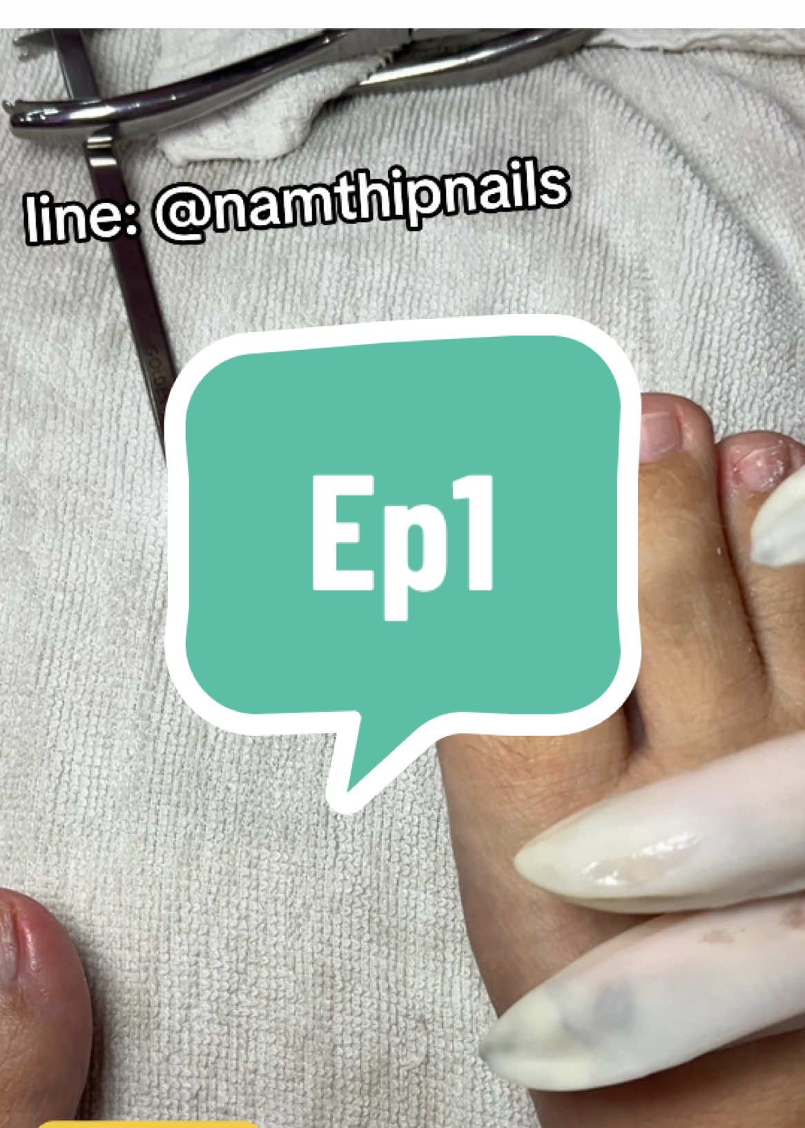 A post by @namthipnails5 on TikTok caption: 💓 #namthipnails #ตัดเล็บขบ #ตัดหนัง #ทำเล็บ #ร้านตัดเล็บขบ #ร้านตัดเล็บขบราม2 #ตัดเล็บ #เล็บขบ  #เล็บเชื้อรา Fb : namthipnails  Line : @namthipnails  นัมเบอร์วัน8 ตลาดม.ราม2  กทม  Map: namthipnails  https://goo.gl/maps/JmwpCKLfKwmhKGK96  ร้านเปิดทุกวัน เวลา12.00น-22.00น.