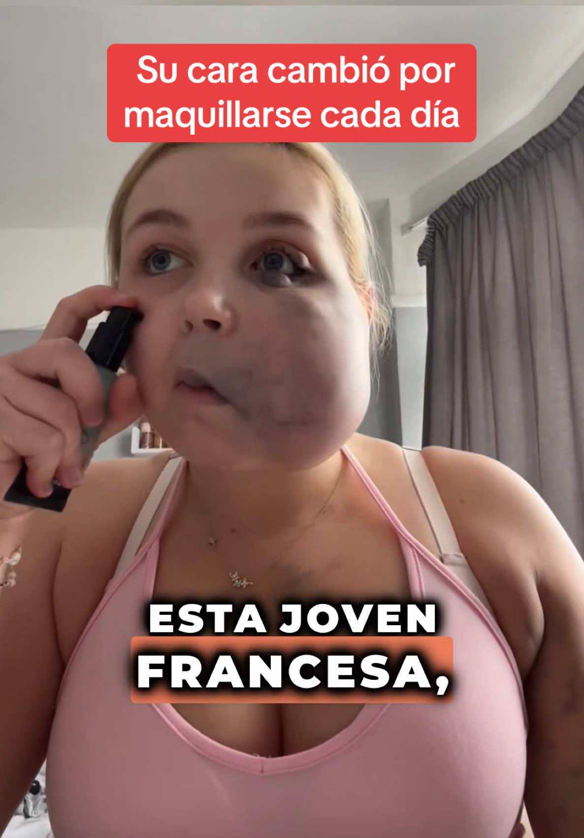 A post by @historia_real_estr on TikTok caption: Desde los 11 años, esta joven francesa usaba maquillaje todos los días sin fijarse en la calidad. Pero hace dos semanas, su mejilla empezó a hincharse de forma alarmante. En urgencias, los médicos descubrieron algo tan impactante que nadie podía creerlo. Comenta "Maquillaje" para la parte 2. #sorprendente #historiasimpactantes #Sorpresa #misterio 