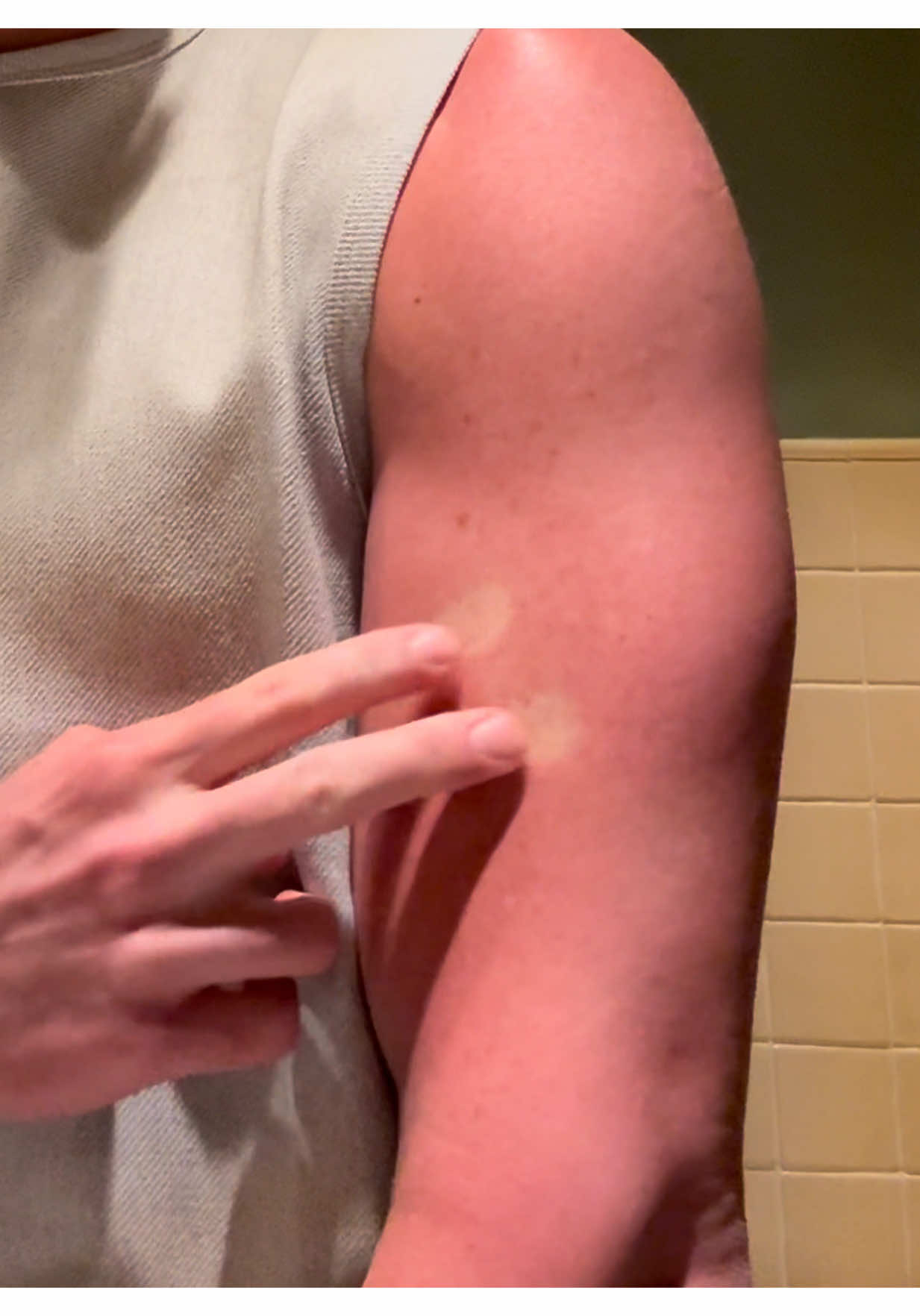 A post by @harryjowsey on TikTok caption: @Pash Skin Protection  🌿 Lime caviar (aka finger lime) is rich in natural AHAs (alpha hydroxy acids) and citric acid, which gently exfoliate the skin. Why it matters: It breaks down dead skin cells, boosts cell regeneration, and leaves the skin smoother, brighter, and more even-toned. It also enhances the absorption of other ingredients like aloe vera and seaweed. 💧 Aloe vera is the GOAT of skin hydration and repair. Why it matters: It’s loaded with vitamins A, C, E, and enzymes that soothe irritation, calm redness, and help heal wounds, burns, or acne flare-ups. It locks in moisture without clogging pores, making it perfect for all skin types (even sensitive or oily). 🌊 This rare seaweed is rich in fucoidans, polysaccharides, and antioxidants. Why it matters: It strengthens the skin barrier, protects against pollution and UV damage, and stimulates collagen production for firmer, younger-looking skin. It helps fight pigmentation and dullness while giving skin a luminous glow. In short: ✨ Lime caviar resurfaces 🌱 Aloe vera heals and hydrates 🌊 Golden seaweed protects and restores