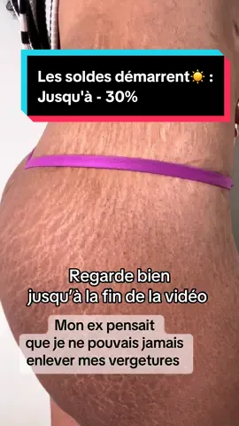 A post by @dialuskinfr on TikTok caption: Les soldes démarrent☀️ : Jusqu'à - 30% Des soins qui offrent des résultats visibles, à prix doux pour sublimer ta peau tout l'été ! #stretchmark #stretchmarks #stretchmarkremoval #vergetures #fypppppppppppppppppppppppp #pregnant #avantapres #dialuskin #pourtoi 