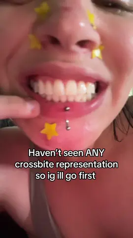 A post by @daniellesadvocacy on TikTok caption: I had to have speech therapy to say my s and T sounds bc of it🙄 but I love it ab me❤️