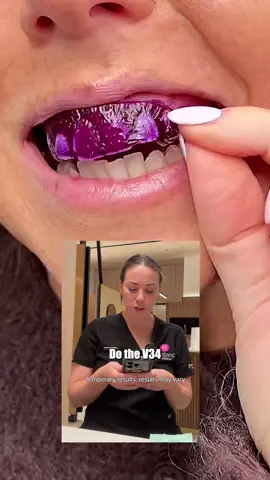 A post by @hismile on TikTok caption: The TRUTH has been spilled 😳 #explained #exposed #dentaltok #ad
