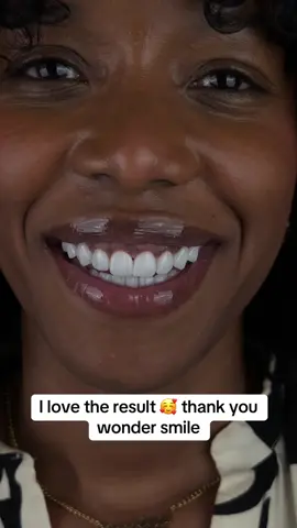 A post by @wondersmiledentalcenter on TikTok caption: ✨ A new smile, a new you. Porcelain veneers — natural, long-lasting beauty. 🎆 4th of July Promo: $6,200 (was $7,200) 📲 Text us to book: +1 (561) 668-5094 #veneersjourney #porcelainveneers #neworleansveneers #chicagoveneers #dentistry #veneerscolombia #bestdentalclinic #veneers #miamiveneers #hollywoodsmile #smiledesign #cosmeticdentist #cosmeticdentistry #dentaltourism #smiledentist #bestdentist #lifechanging #houstonveneers #exportingsmiles 
