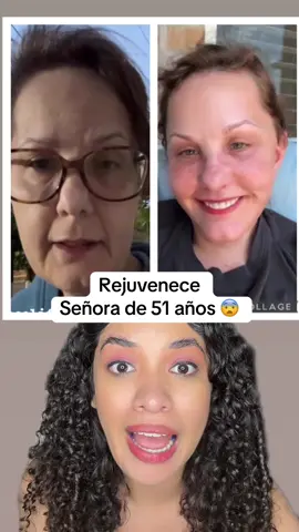 A post by @dayanechrissel on TikTok caption: Señora de 51 años se hizo facelift en Guadalajara y tiene a todos impactados con el resultado chisme #chisme #chismepotente #usa 