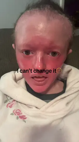 A post by @hootieq._ on TikTok caption: 🫥#fyp #fypシ゚viral #fypシ 