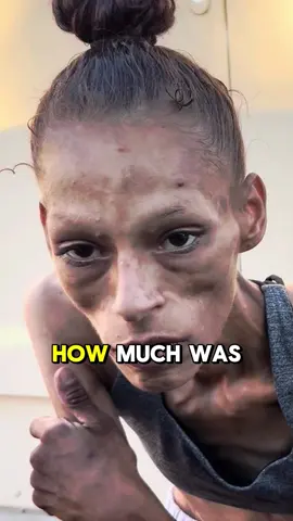 A post by @talesfromthestreets6 on TikTok caption: Jessica is 29 years old, weighs 80 pounds on Zion scales, she agreed I took her to the hospital #lostinphoenix #talesfromthestreets #streetdisclosures #interviewhomeless #Art #homelesspeople #homeless #jessica29homeless #zionhomeless