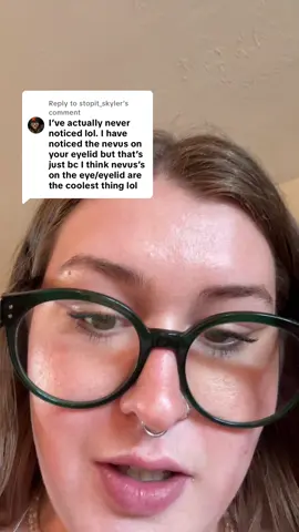 A post by @emhahee on TikTok caption: Replying to @stopit_skyler word of the day is Nevus 