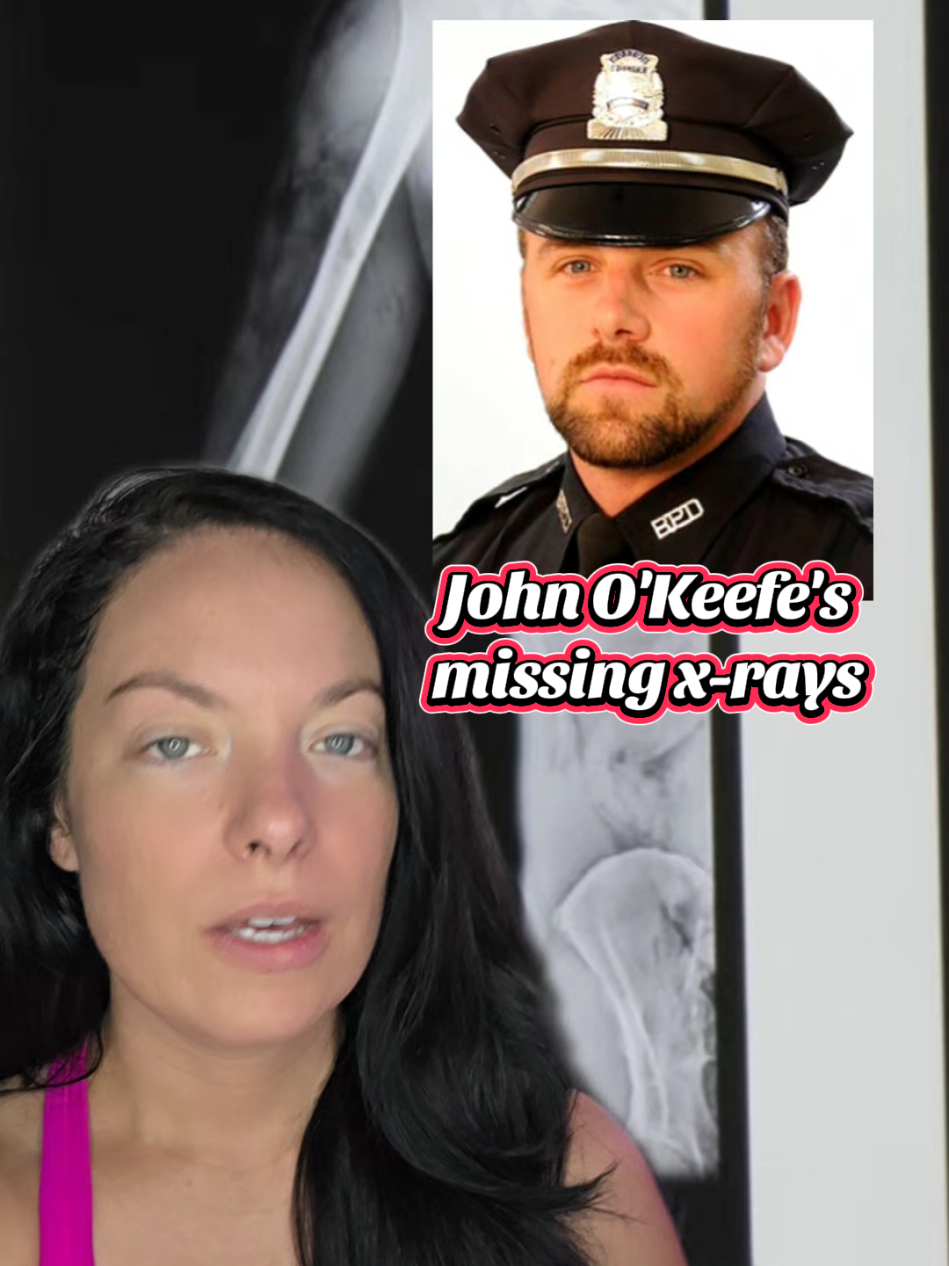 A post by @boozeybeauty on TikTok caption: John O'Keefe's missing x-rays #KarenRead #JohnOKeefe #KarenReadTrial #justiceforjohnokeefe #BreakingNews #LegalNews #CantonMA #CrimeTok #TrueCrime #Boston #massachusetts #alanjackson 