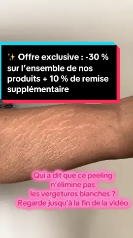 A post by @dialuskinfr on TikTok caption: 🌞 Offre exclusive : -30 % sur l’ensemble de nos produits + 10% de remise supplémentaire avec le code SUMMER10 #stretchmark #stretchmarks #stretchmarkremoval #vergetures #maroc #avantapres #pourtoi #fypppppppppppppppppppppppp #obesity 