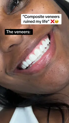 A post by @wondersmiledentalcenter on TikTok caption: “Composite veneers ruined my life.” And then… the transformation 🦷✨ Turns out, the problem wasn’t the veneers — it was where I got them. Come see the difference with real smile experts 😍 📍Miami 📲 561-668-5094 #S#SmileMakeover #C#CompositeVeneers #V#VeneersGoneWrong #B#BeforeAndAfter #V#ViralSmile #D#DentistTikTok #M#MiamiSmiles #D#DentalTransformation #V#VeneersFix #G#GlowUp #S#SmileJourney #T#TikTokMadeMeDoIt #C#CosmeticDentistry #V#veneersjourney 