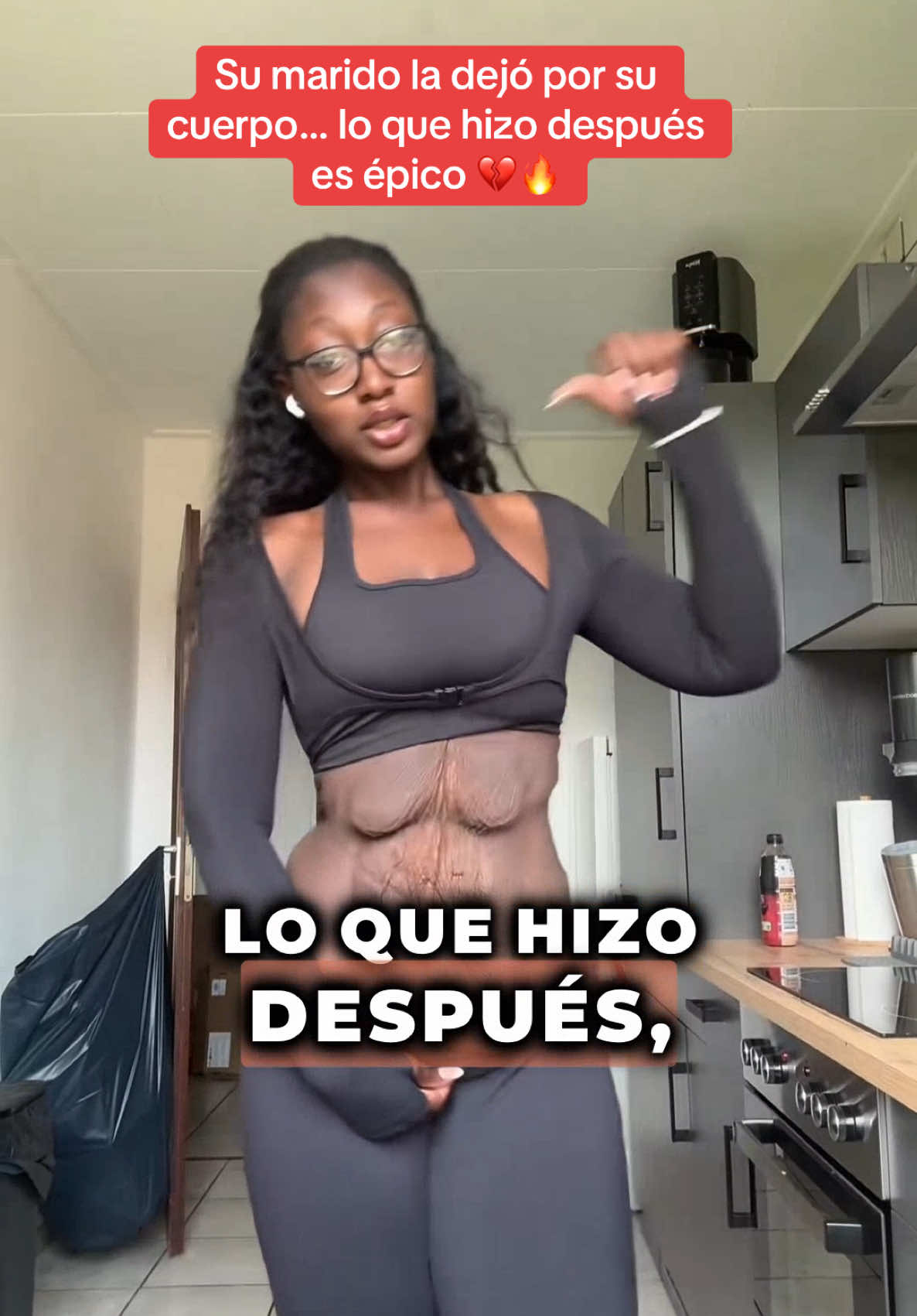 A post by @historia_real_estr on TikTok caption: Esta joven fue juzgada por años por su peso. Cuando logró perder más de 40 kg, su esposo la insultó y la abandonó por cómo había quedado su vientre. Pero en vez de rendirse, ella transformó su dolor en fuerza. Mostró su verdad sin filtros en TikTok, inspiró a miles, y hoy es modelo. Lo que hizo después dejó a su ex completamente destruido. ¿Quieres saber qué pasó? Comenta “Bella” para ver la segunda parte. 💪✨ #historiasimpactantes #sorprendente #Sorpresa #misterio 
