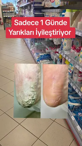 A post by @gurbetana27 on TikTok caption: #voiceeffects #videoviral #learnontiktok #fypviralシ 