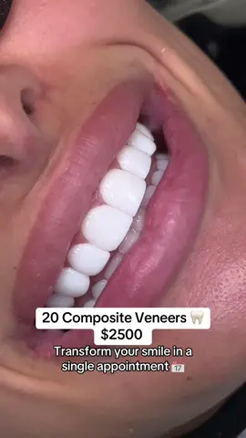 A post by @wondersmiledentalcenter on TikTok caption: Few appointments available 📲561 668 5094 #veneersjourney #porcelainveneers #neworleansveneers #chicagoveneers #dentistry #veneerscolombia #bestdentalclinic #veneers #miamiveneers #hollywoodsmile #smiledesign #cosmeticdentist #cosmeticdentistry #dentaltourism #smiledentist #bestdentist #lifechanging #houstonveneers #exportingsmiles