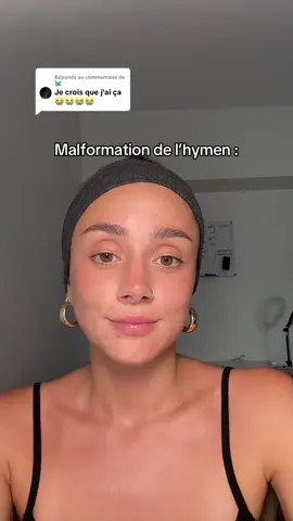 A post by @jadorelle on TikTok caption: Réponse à @🦋 Antoine Drain, allez-y les yeux fermés ! #fyp #pourtoi #malformation 