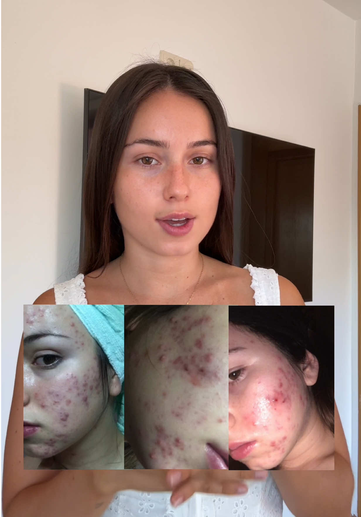 A post by @lilimaartineez on TikTok caption: Como embajadora te confirmo que mi piel siempre fue mi mayor trauma, pero con la ayuda de la gama Minéral 89 de @Vichy Laboratoires siento que ha mejorado mucho. #MEvsDEHYDRATION #VichyLaboratoires #Mineral89 #skincare #skinbarrier #hydration