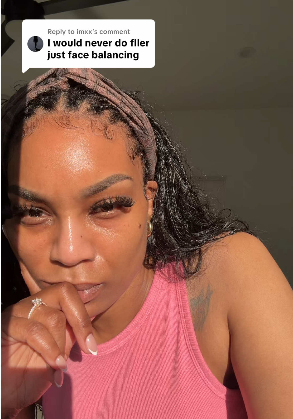 A post by @ardiej83 on TikTok caption: Replying to @imxx please do your research before you get facial balancing❤️ #facialbalancing #fillers💉 #filler #undereyefiller #fyp 