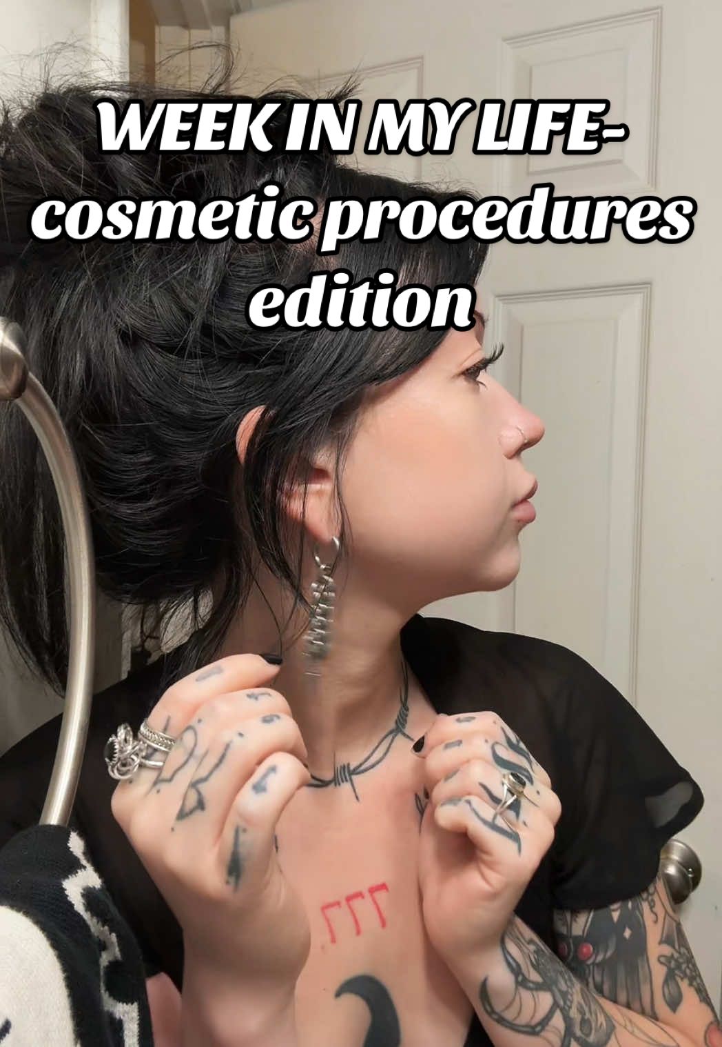 A post by @thelifeofc__ on TikTok caption: everyone wants transparency until you’re transparent in a way they don’t like 🤷🏻‍♀️ #dissolvingfiller #dissolvinglips #lipfiller #chinfiller #masseterbotox #cosmeticprocedures #DayInMyLife #dayinmylifevlog #weekinmylife #weekinmylifevlog #comewithme #diml #wiml #tmjtreatment #tmjbotox #jowls 