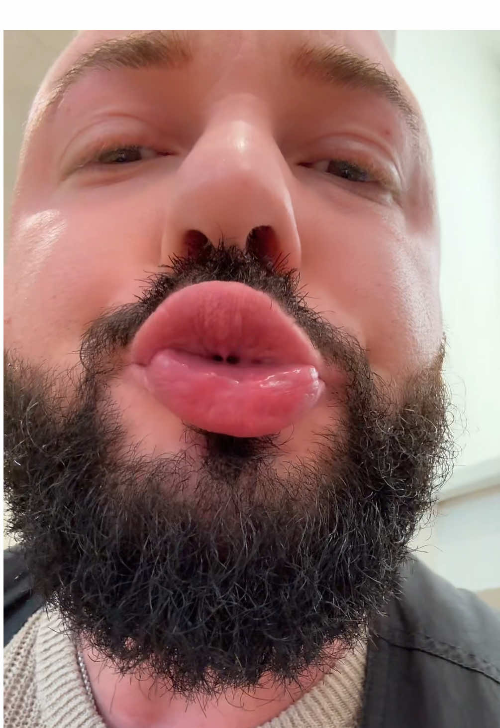 A post by @boneshandsanimals on TikTok caption: 🌿 Magen-Darm-Pulver für Hunde – für einen glücklichen Bauch und entspanntes Gassigehen! ✨ Was dein Hund davon hat: ✅ Unterstützt die Verdauung bei Durchfall, Erbrechen oder Grasfressen ✅ Fördert gesunde Darmbakterien & reduziert schädliche Keime ✅ Stärkt das Immunsystem mit speziell ausgewählten Darmkulturen ✅ Mehr Energie dank Vitamin-B-Komplex 💥 🥄 Einfach in der Anwendung: ✔ Leicht unters Futter mischen, wird super akzeptiert ✔ Getreidefrei, vegan & hypoallergen – perfekt für empfindliche Fellnasen ✔ Frei von künstlichen Zusätzen & Schwermetallen ✔ Schonende Herstellung für beste Verträglichkeit 🇩🇪 Qualität, der du vertrauen kannst: 🔹 Entwickelt mit Tierärzten 🔹 Hergestellt & geprüft in Deutschland 🔹 Lichtgeschützte Verpackung für maximale Frische #foryou #asmr #animal #chiropractortiktok #türkiye #hundeauftiktok #hund #tiere #Love #animals #bochum #animal 