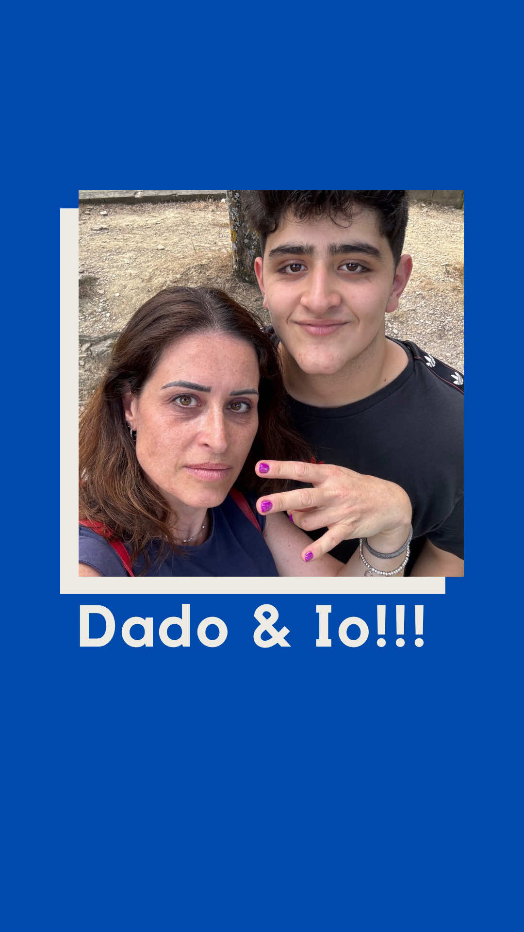 A post by @ginecologacalcagni on TikTok caption: Davide e’ a New York a studiare e non possiamo girare il nostro contenuto. Così oggi vi ripropongo il primo video della nostra  rubrica “Dado&Io” girato esattamente un anno fa. Lo scopo di questa rubrica e’ affrontare insieme discorsi che possono allontanare genitori e figli. Negli ultimi anni, l'epilazione maschile è diventata sempre più popolare. Molti uomini scelgono di rimuovere i peli superflui per vari motivi: estetica, igiene, comfort personale o performance sportiva. Le tecniche disponibili sono molteplici, dalle cerette alle creme depilatorie, fino ai trattamenti laser permanenti. Sono curiosa di sapere cosa ne pensi!  Personalmente preferisco l’uomo col pelo ma rispetto le opinioni diverse dalle mie tanto che ho depilato mio figlio. E tu? Cosa pensi degli uomini che si  depilano? #dadoeio #rubrica #donne #uomini #depilazione #ceretta #epilazione #figli #dialogo #noi #famiglia #divulgazionescientifica #ginecologacalcagni #mamma #genitoriefigli 