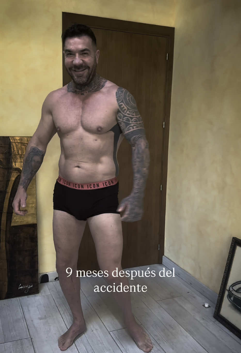 A post by @xavi.caballol on TikTok caption: 9 meses después del accidente que casi me lo quita todo 💪🏻 Cuando la vida te pega fuerte puedes: - Quedarte en el suelo y renunciar a quien eres.  - Levantarte más fuerte que nunca y demostrar quien eres.  #vida #gym #actitud #superacion #fitness #fisioterapia 