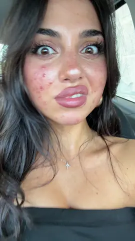 A post by @belikeanna on TikTok caption: face card così crazy finché non è tornata l’acne