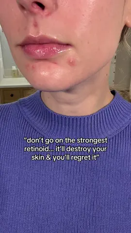 A post by @abbeyyung on TikTok caption: I saw a lot of comments like this when I shared that I was going off of Tretinoin to switch to Tazarotene. This was my derm’s recommendation (you can’t get an Rx for either of these without going to a derm in person or online), so I trusted that over the comments. And I’m so glad I did! Tazarotene is said to be the strongest retinoid but switching to this (plus Azelaic Acid) was the most seamless transition ever. I truly had zero irritation, my skin barrier wasn’t “destroyed” and overall it was clear that this was the right change for my skin to help with acne so I have no regrets! For all my acne prone viewers… don’t let the internet make you feel bad for using something your derm prescribed. Acne sucks & there’s no shame in whatever you choose to do to treat it 💗 #acne #acnetreatment #skincarejourney #tretinoin 