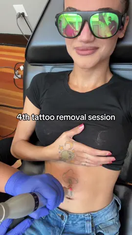 A post by @ on TikTok caption: Thank you @Removery Laser Tattoo Removal for helping me continue my new journey & era!   #removery #tattooremoval 