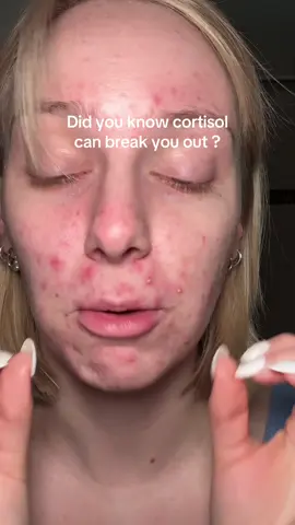 A post by @thatkaitysmith on TikTok caption: This @Beekman 1802 magnesium mist calms my skin AND supports my barrier. microbiome friendly + rosacea approved 🫶 #Beekman1802Partner #sensitiveskin #ultabeauty