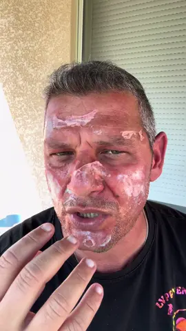 A post by @lvprvention on TikTok caption: Un coup de soleil, ce n’est pas juste une petite brûlure ! Certaines recettes de grand-mère peuvent empirer la situation et mettre ta peau en danger. Dans cette vidéo, je t’explique ce qu’il faut vraiment faire (et surtout éviter) ! #coupdesoleil #préventionété #astucesanté #secourisme #dangerété #conseilutile #gestesquisauvent 