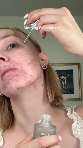 A post by @thatkaitysmith on TikTok caption: Today is gonna be a great day guys #acne #grwm #morningskincare @anua_global @Kiehl's Since 1851 @Beauty of Joseon @iUNIK 
