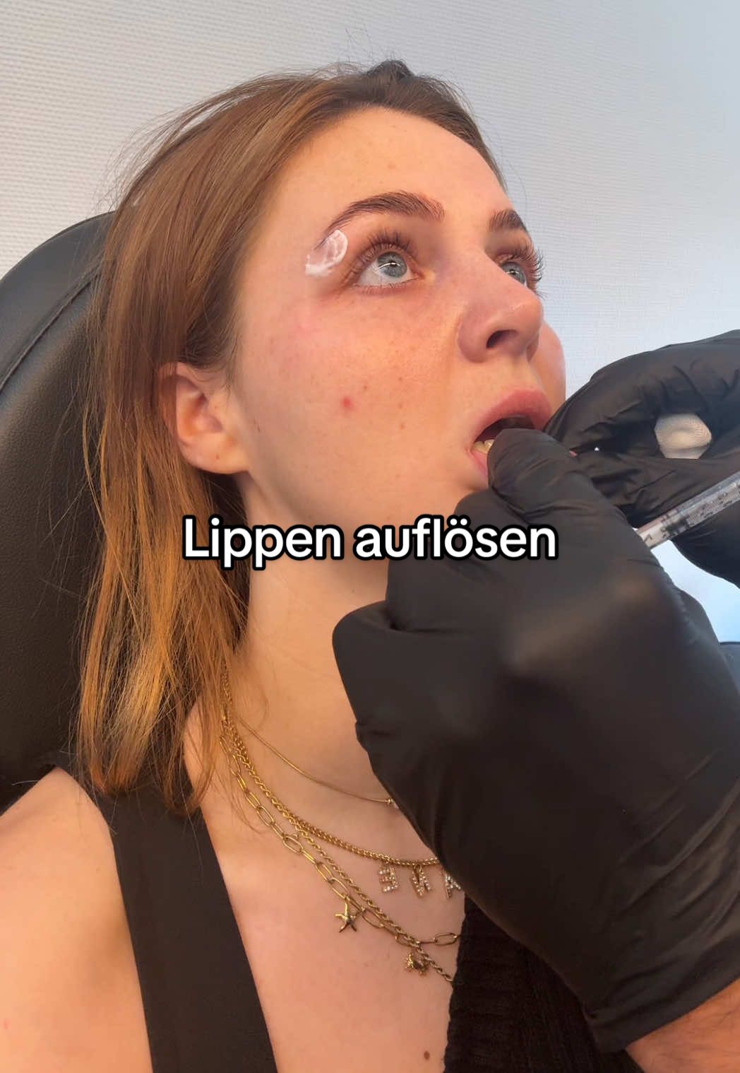 A post by @yujolie on TikTok caption: Instagram: _yujolie  Hast du gemachte Lippen ?🙂‍↕️🤠 #lips #lipgfiller 
