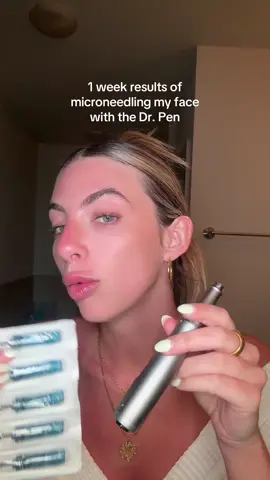 A post by @rachelmadisoncarlisle on TikTok caption: 1 week update of microneedling #microneedling #microneedlingface #drpen 