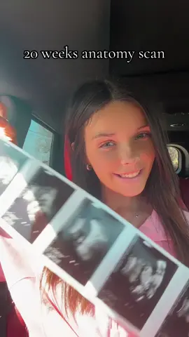 A post by @ on TikTok caption: Baby update💙👶🏼 #19weekspregnant #momlife #MomsofTikTok #momtok #pregnant #pregnantlife #momof4 #pregnanttiktok 