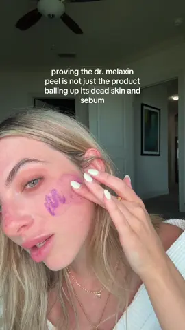 A post by @rachelmadisoncarlisle on TikTok caption: hope this clears things up for the people convinced the peel is fake #peel #drmelaxin #drmelaxinpeelshot 