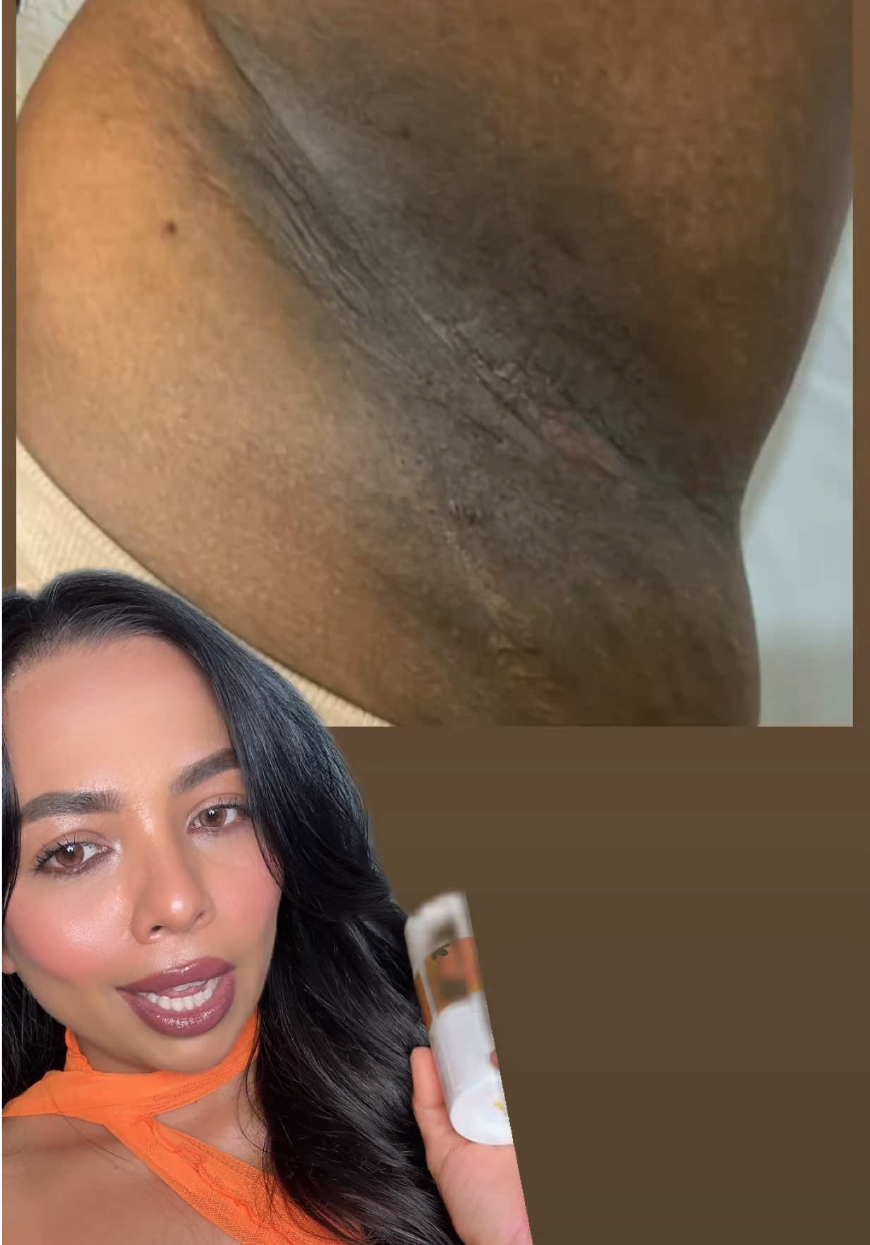 A post by @kripapateljoshi on TikTok caption: Try it once, use it regularly, and thank me later!! The Original Underarm Brightening Deodorant Cream from @forgotten skincare 🥰🥰